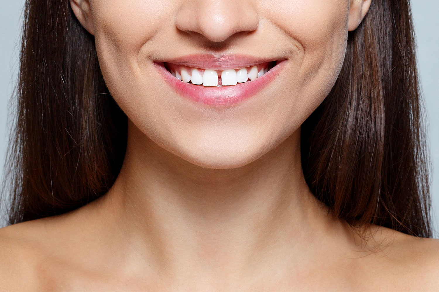 Fix A Tooth Gap: How To Treat Diastema